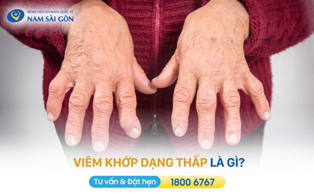 Viem khop dang thap