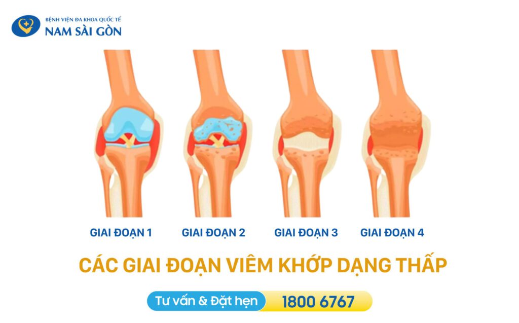 Viem khop dang thap 2