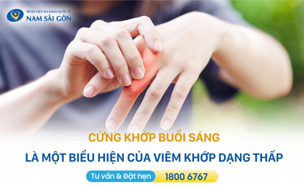 Viem khop dang thap 4