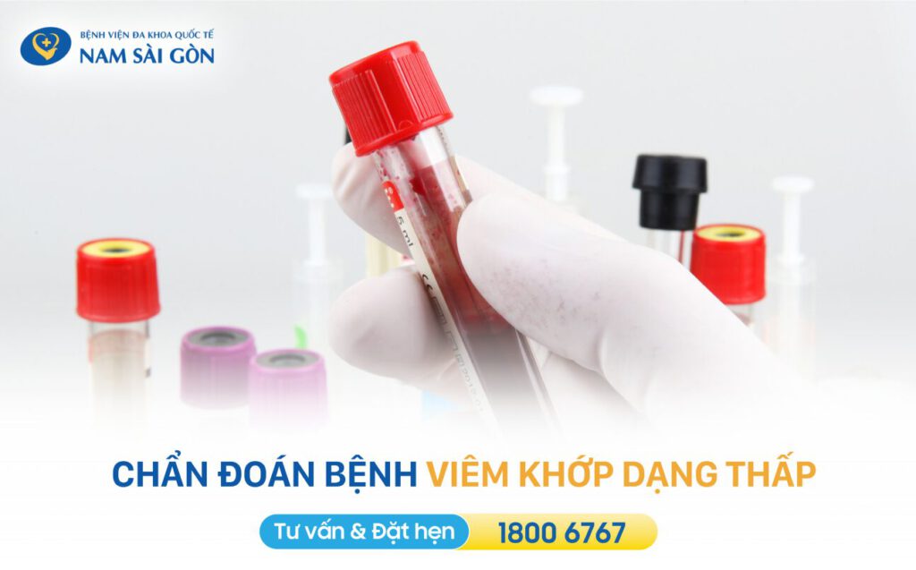 Viem khop dang thap 5