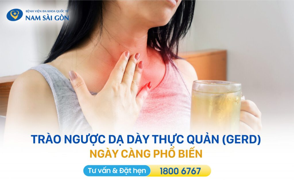 trào ngược là một bệnh tiêu hóa mãn tính