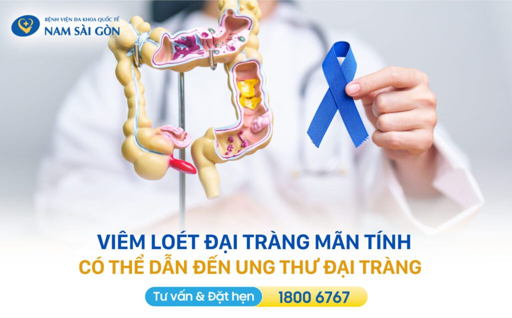 ung thư đại tràng xuất phát từ bệnh tiêu hóa