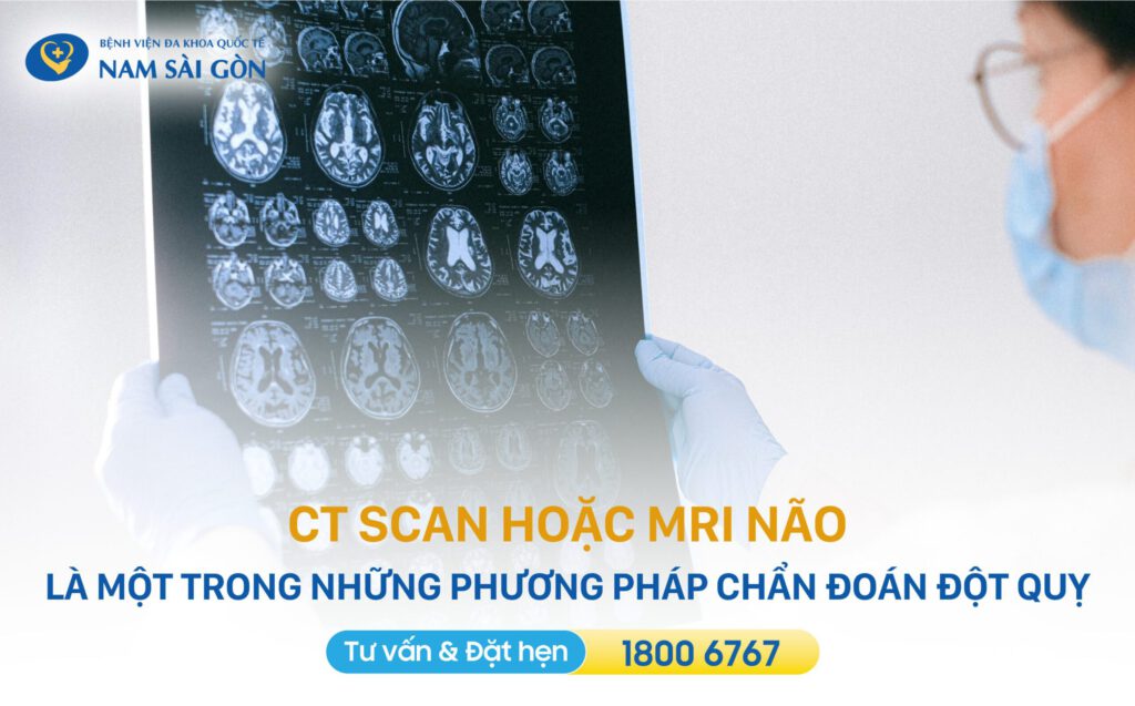 tại sao bị đột quỵ hiện tượng đột quỵ