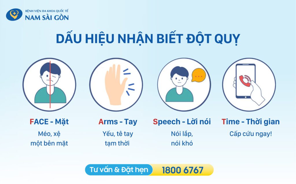 ĐỘT QUỴ - DẤU HIỆU NHẬN BIẾT VÀ CÁCH ĐIỀU TRỊ 2 Dấu hiệu nhận biết đột quỵ.