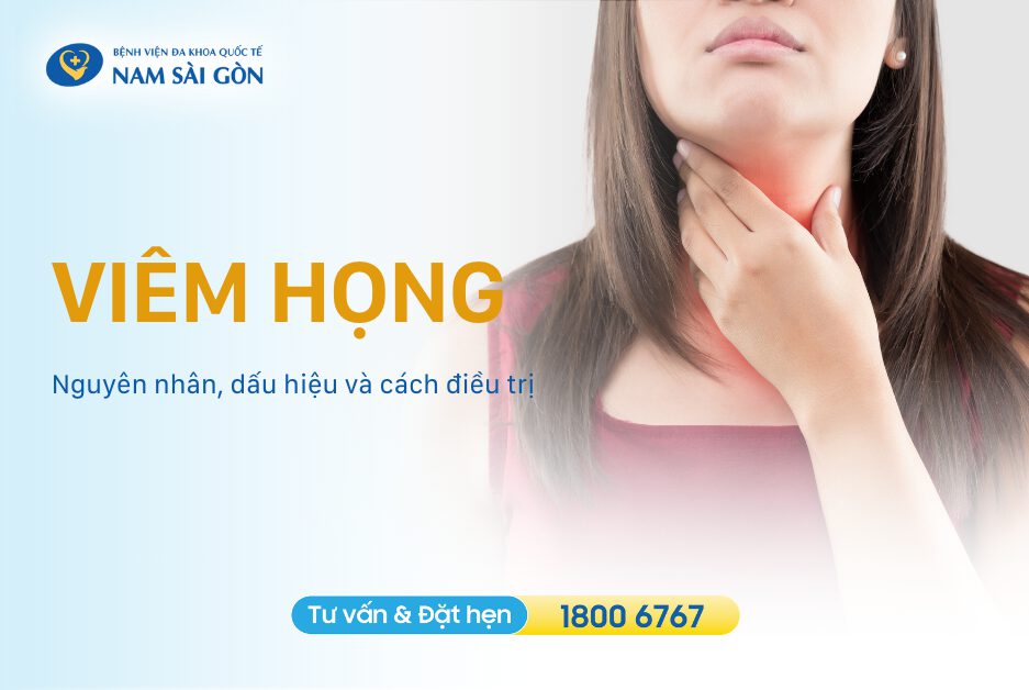 VIÊM HỌNG – NGUYÊN NHÂN, TRIỆU CHỨNG VÀ CÁCH ĐIỀU TRỊ