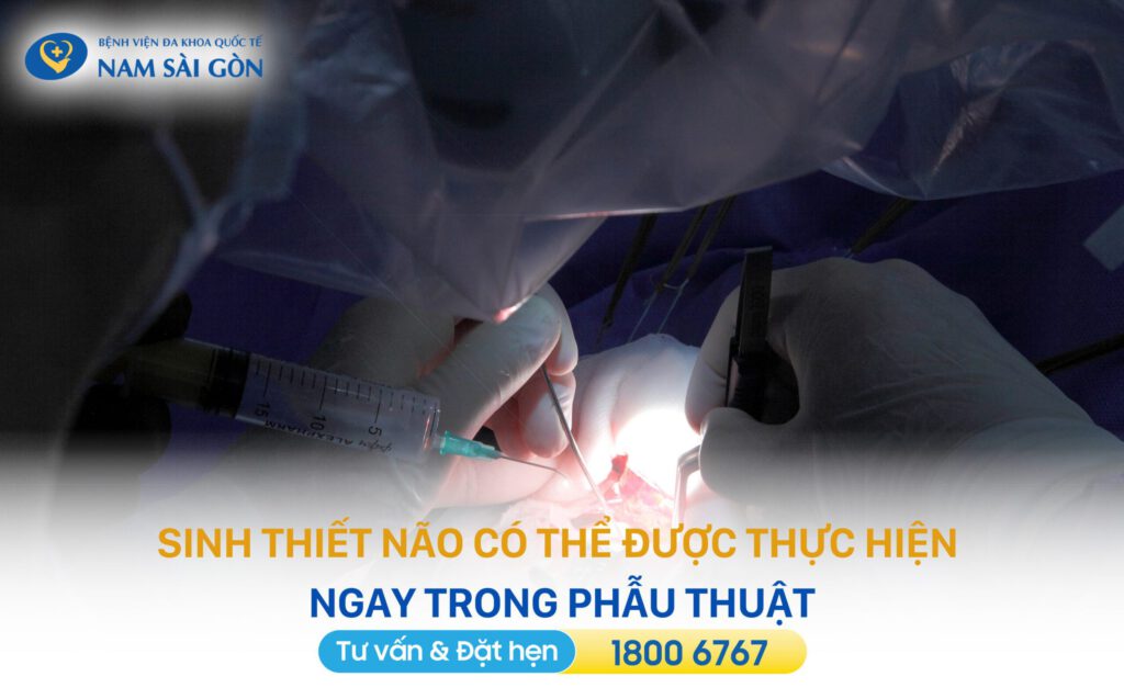 chẩn đoán u não