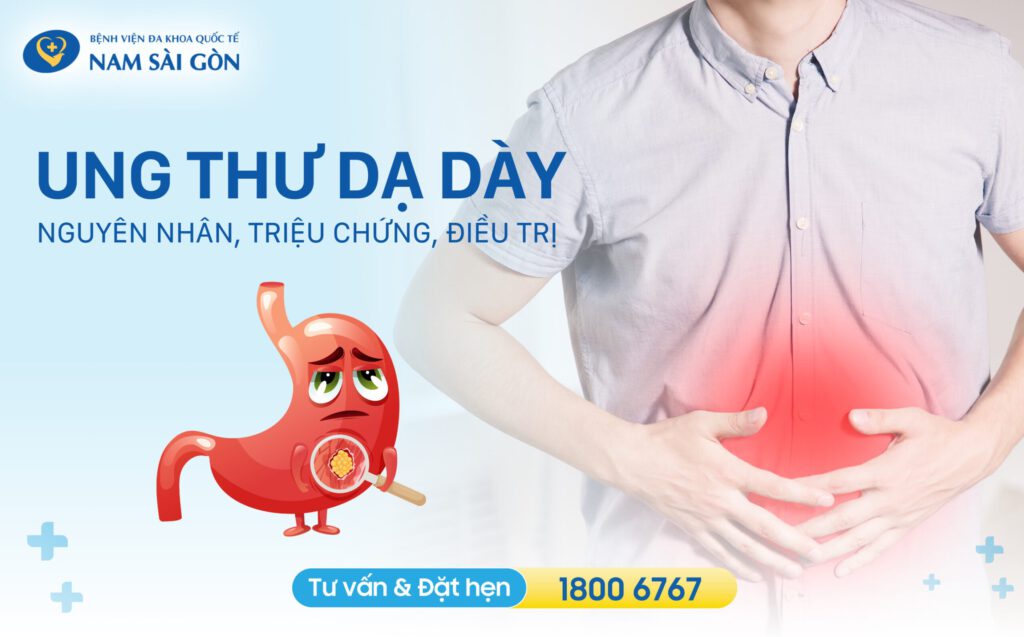 UNG THƯ DẠ DÀY: NGUYÊN NHÂN, TRIỆU CHỨNG VÀ ĐIỀU TRỊ