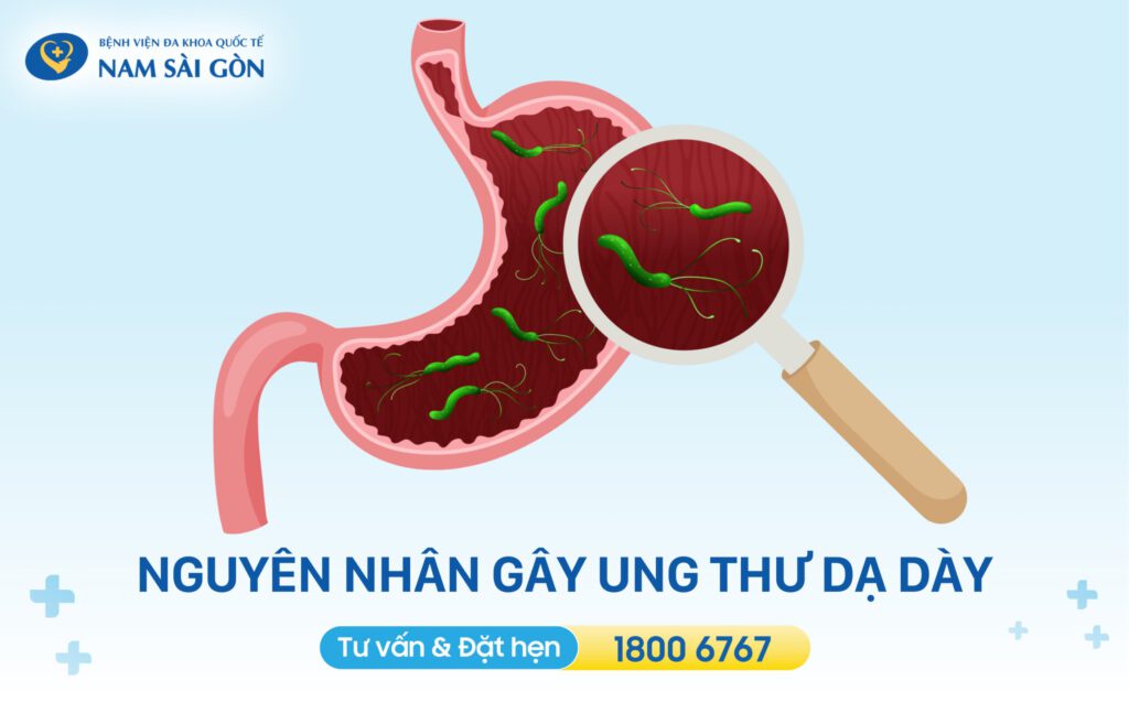 Nguyên nhân gây ung thư dạ dày
