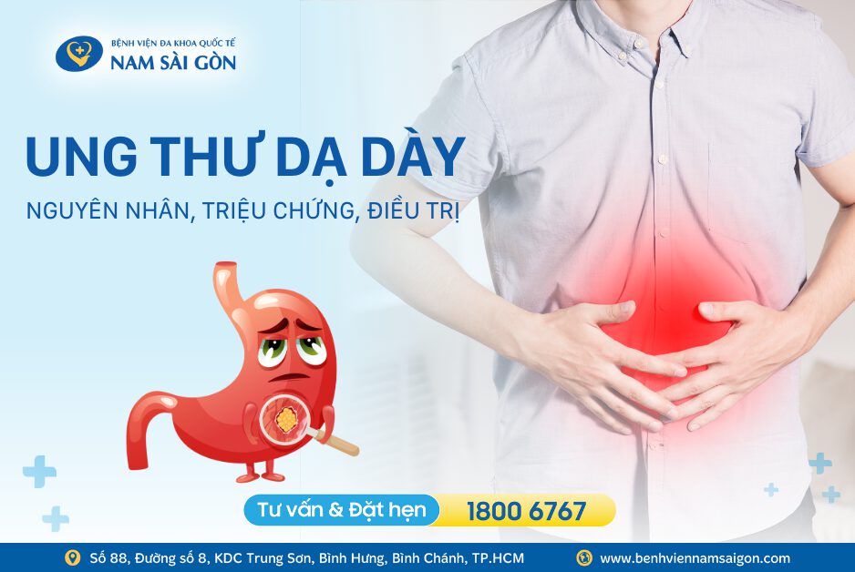 UNG THƯ DẠ DÀY: NGUYÊN NHÂN, TRIỆU CHỨNG VÀ CÁCH ĐIỀU TRỊ