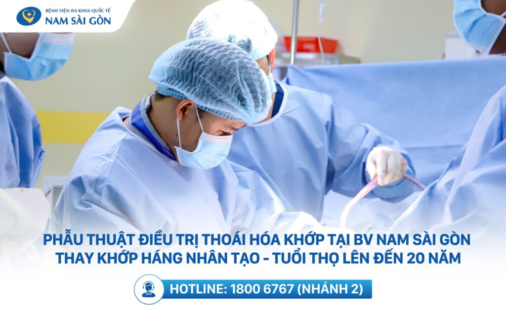 mo khop hang
