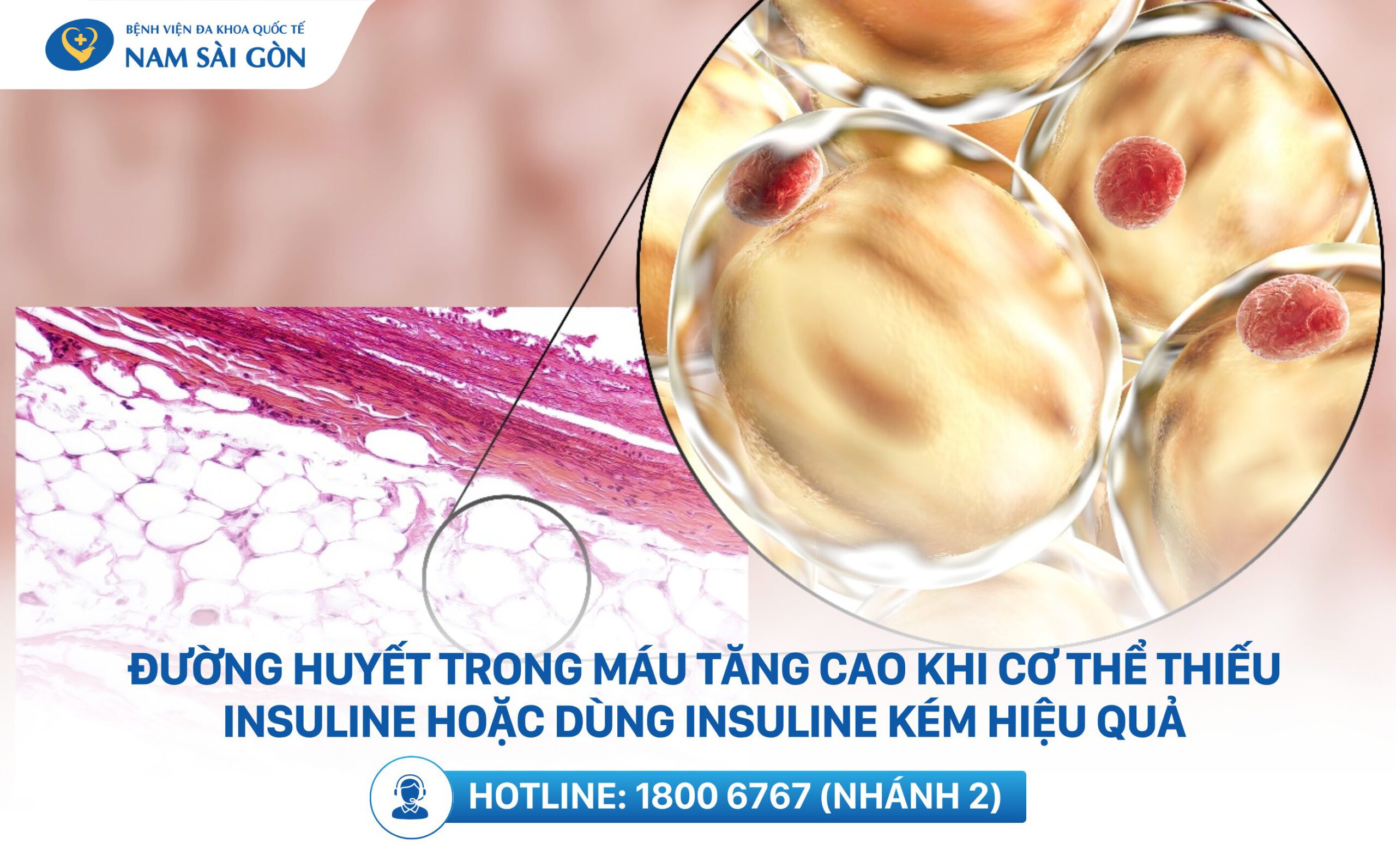 đái tháo đường là gì