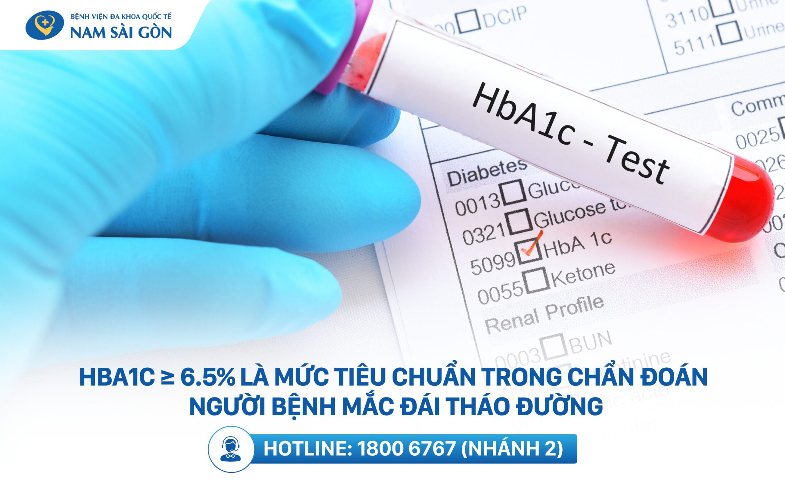 nguyên nhân gây bệnh tiểu đường
