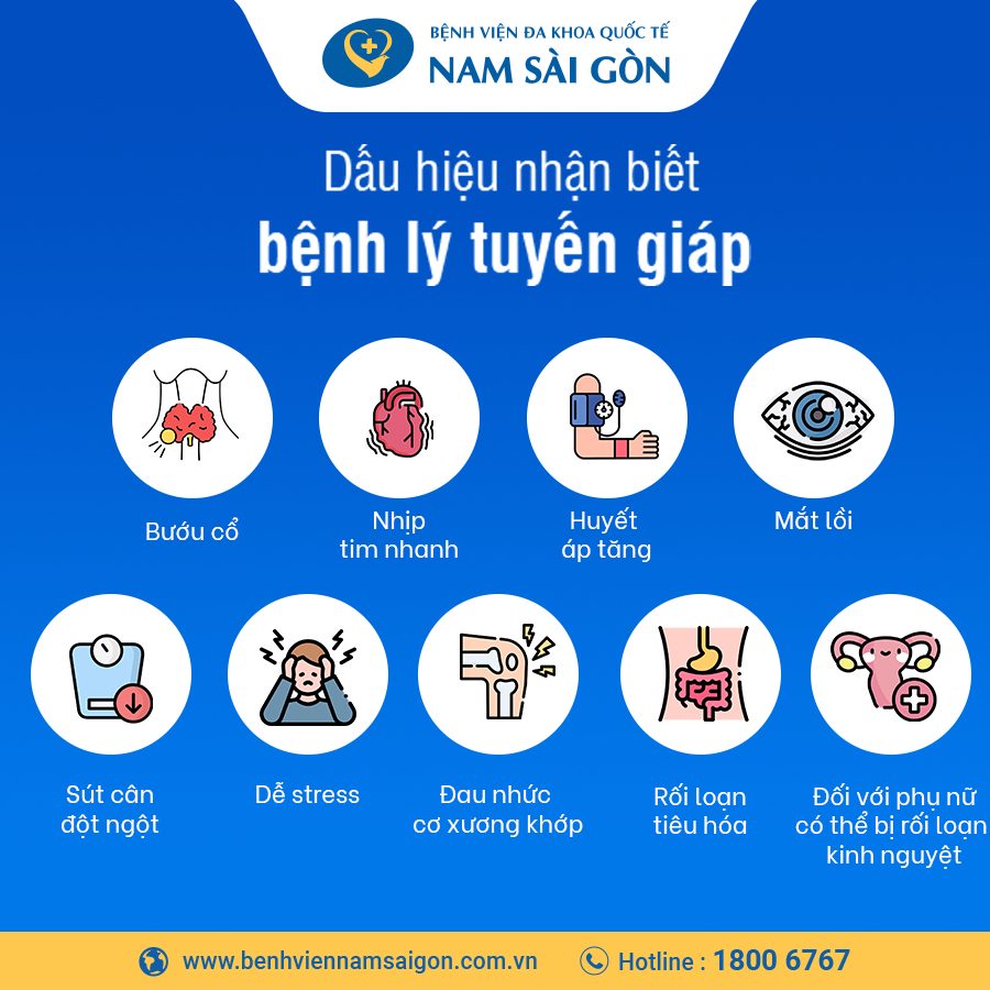 dấu hiệu bị cường giáp