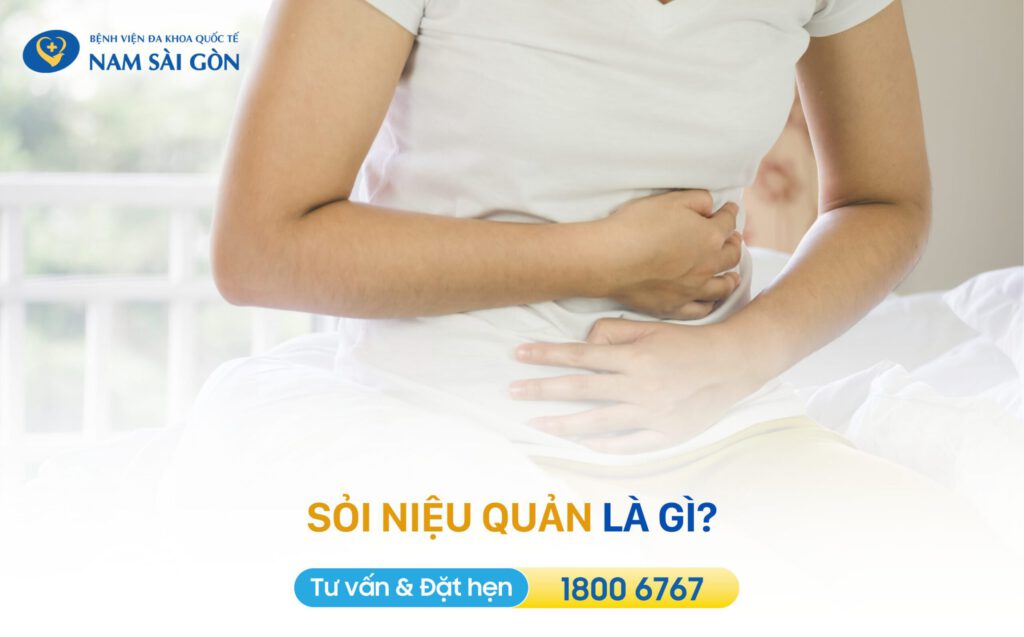 sỏi niệu quản là gì