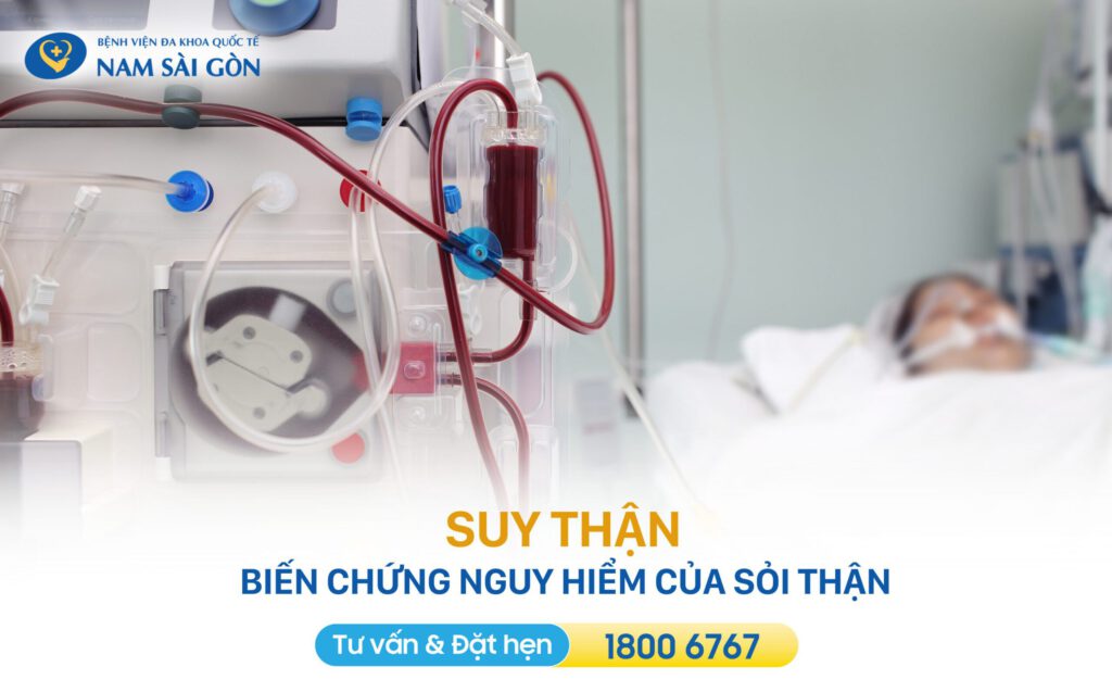 bị sỏi thận sỏi thận nguy hiểm gây biến chứng suy thận