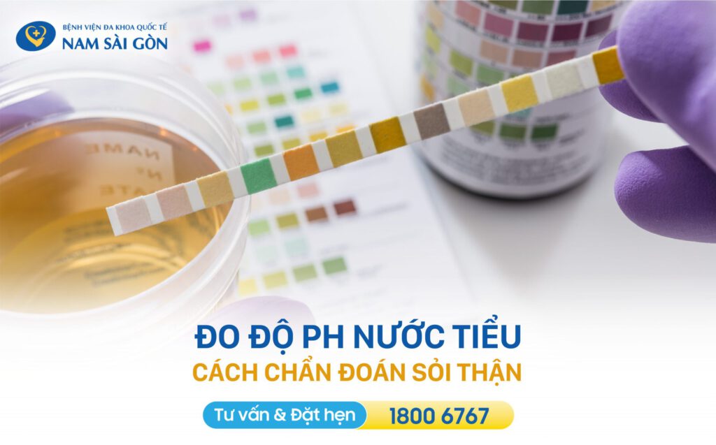 biểu hiện sỏi thận đo ph nước tiểu chẩn đoán sỏi thận