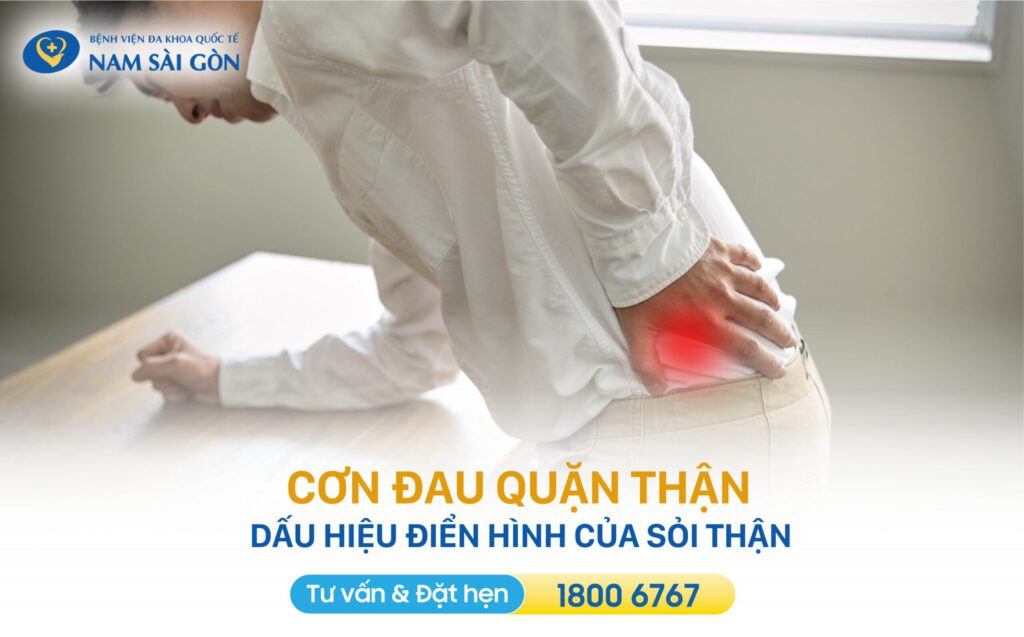 dấu hiệu sỏi thận cơn đau thận dấu hiệu cảnh báo sỏi thận