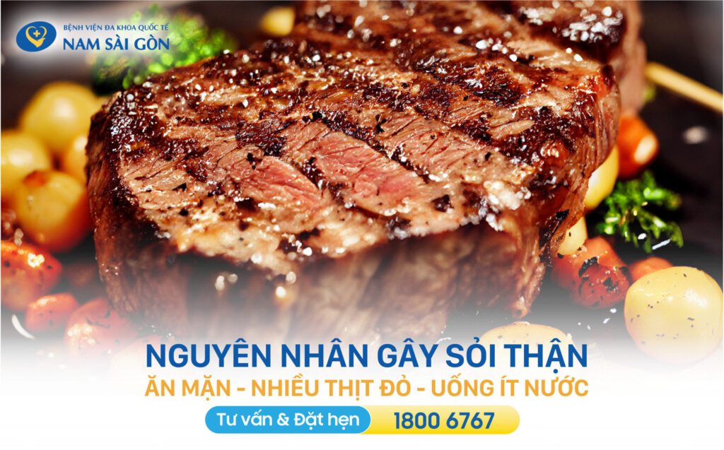 nguyên nhân bị sỏi thận nguyên nhân gây sỏi thận