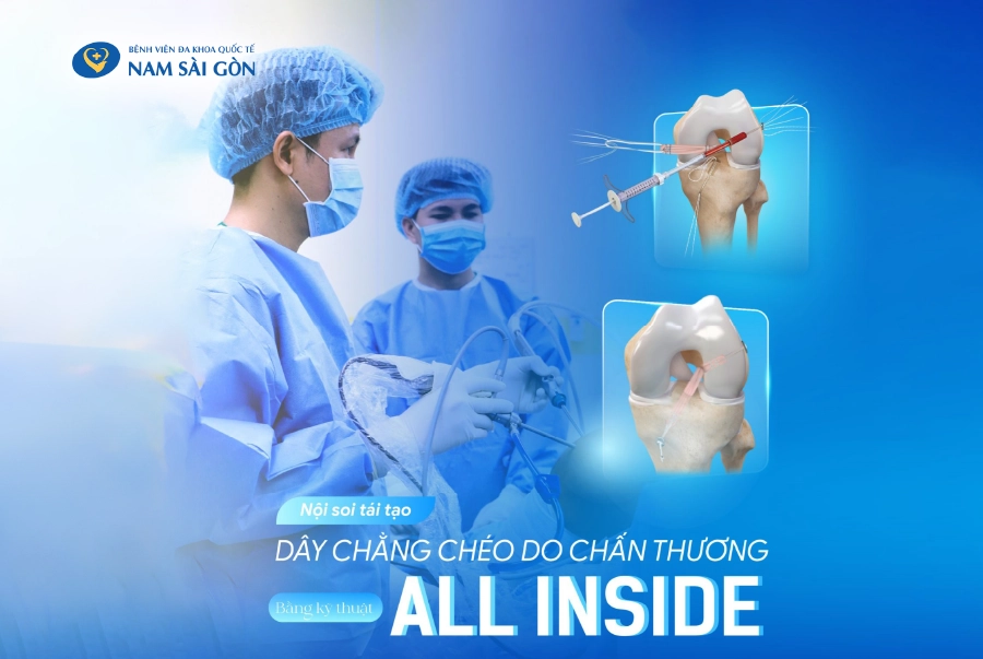 Phuc hoi nhanh sau noi soi tai tao day chang cheo bang ky thuat all inside