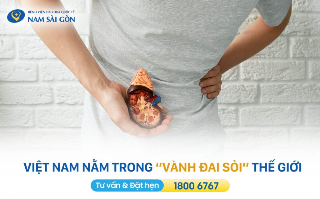 SỎI THẬN - NGUYÊN NHÂN, DẤU HIỆU, CHUẨN ĐOÁN VÀ CÁCH ĐIỀU TRỊ 2 Việt Nam có tỉ lệ mắc sỏi thận cao