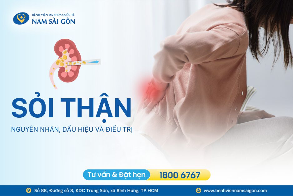 SỎI THẬN – NGUYÊN NHÂN, DẤU HIỆU, CHUẨN ĐOÁN VÀ CÁCH ĐIỀU TRỊ