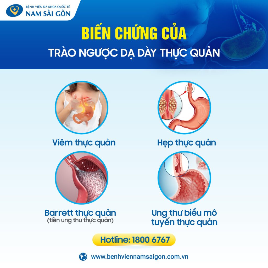 Biến chứng của trào ngược dạ dày thực quản