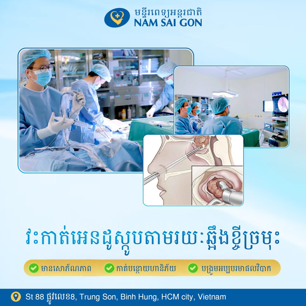 viem xoang buom 2