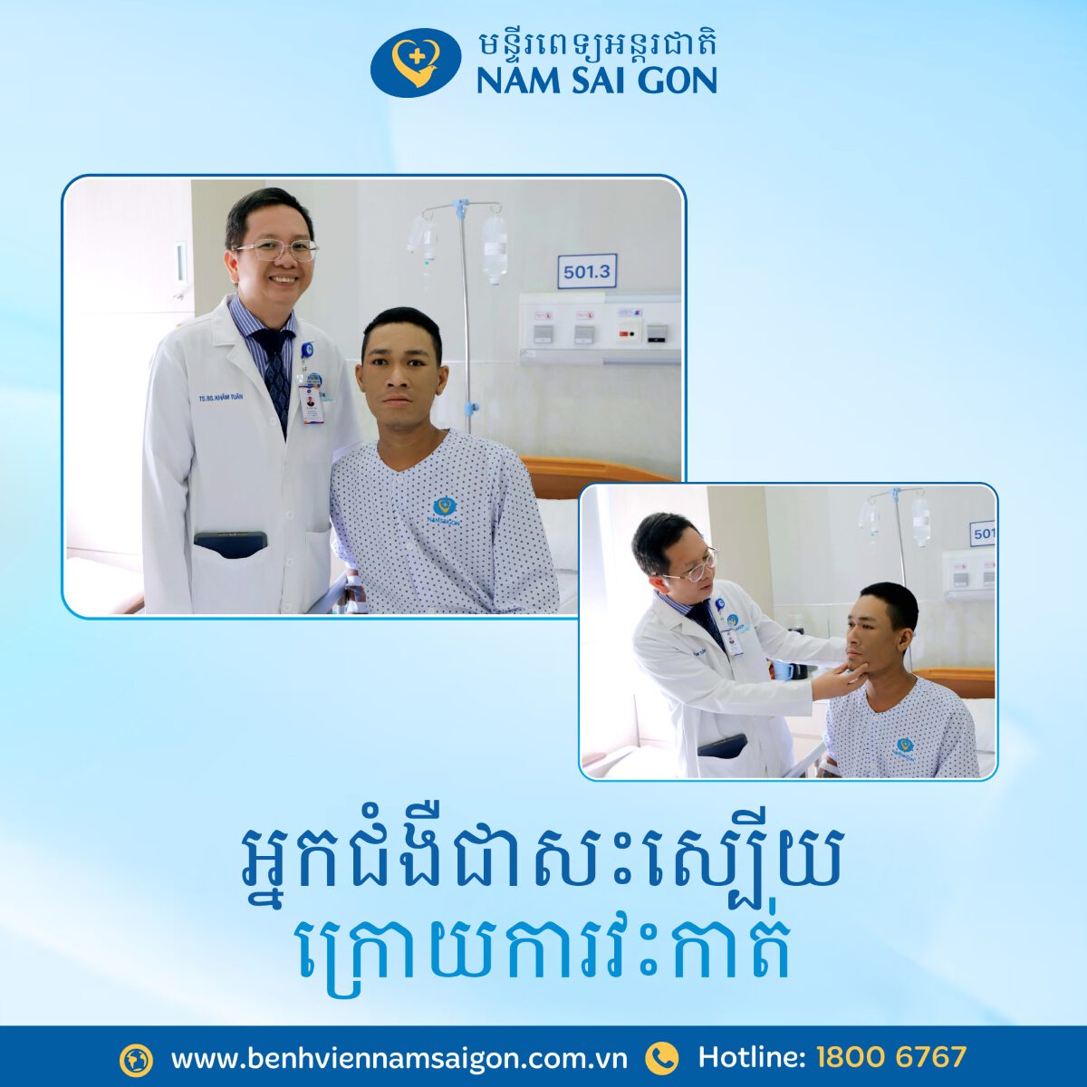 viem xoang buom