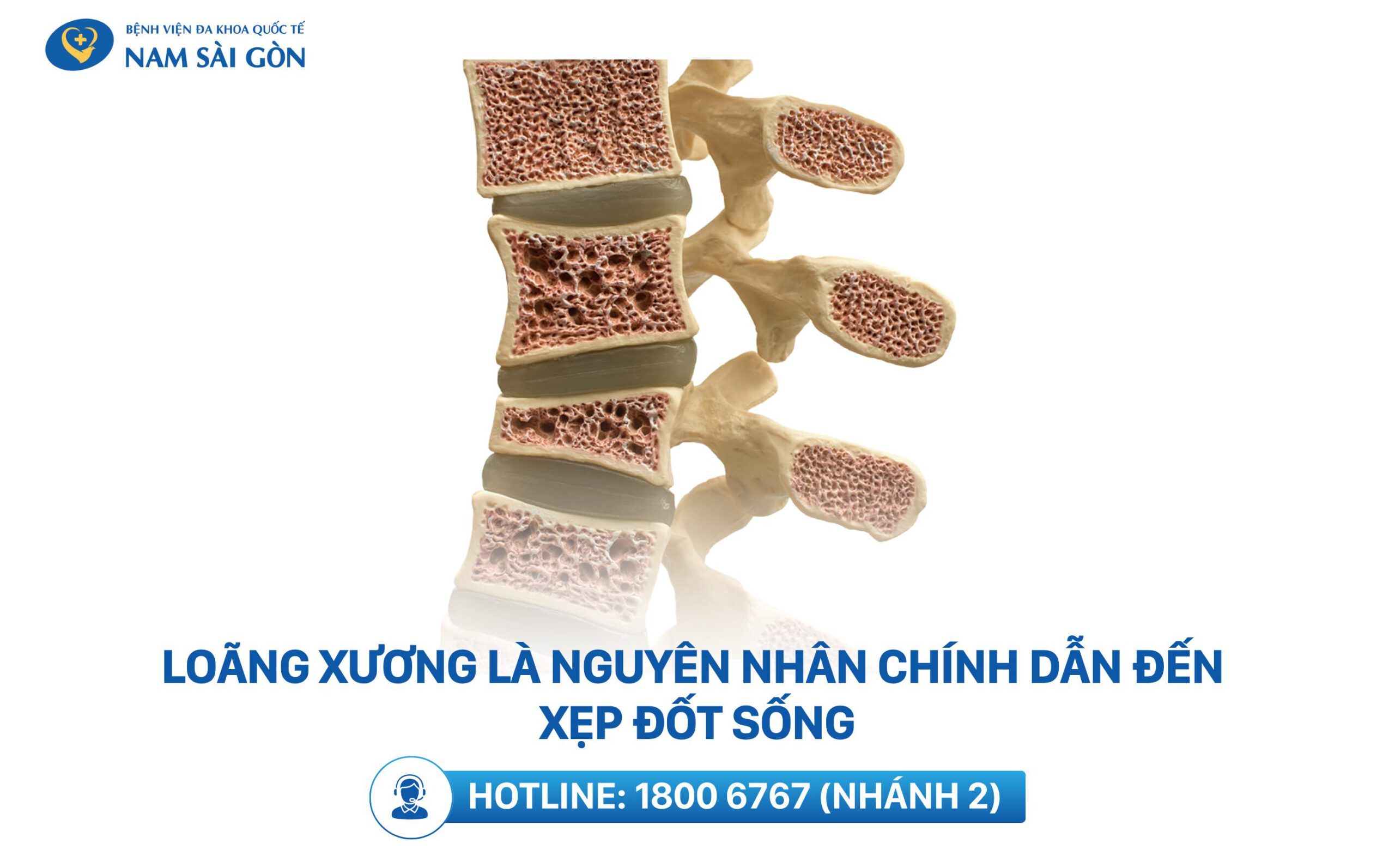 nguyên nhân xẹp đốt sống