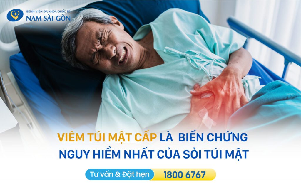 Bị viêm túi mật cấp phải làm những gì?