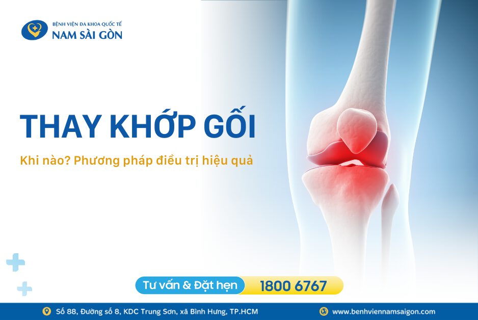THAY KHỚP GỐI LÀ GÌ? KHI NÀO NÊN THAY KHỚP GỐI?