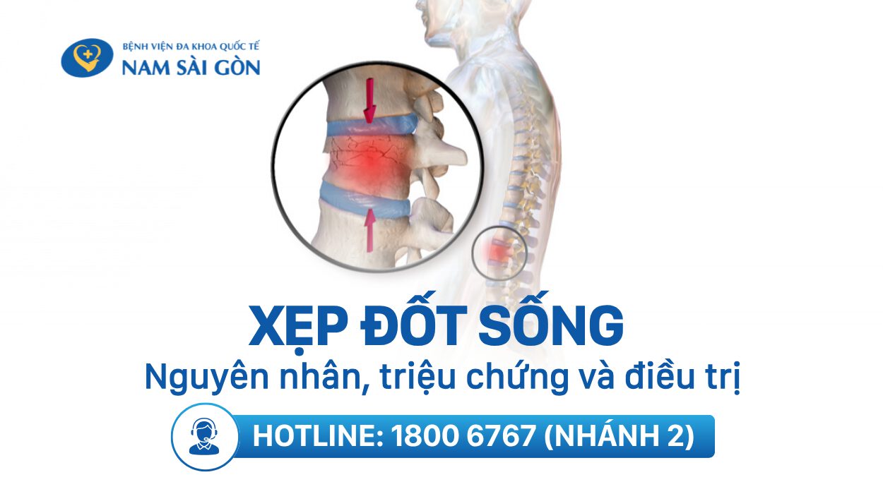 XEP DOT SONG DO LOANG XUONG