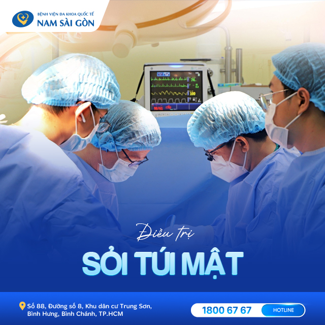 điều trị sỏi túi mật