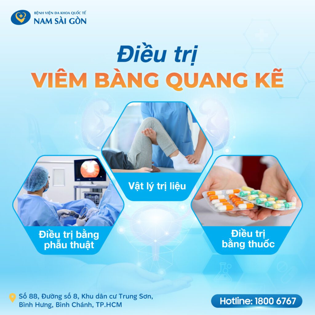 Điều trị bệnh viêm bàng quang kẽ