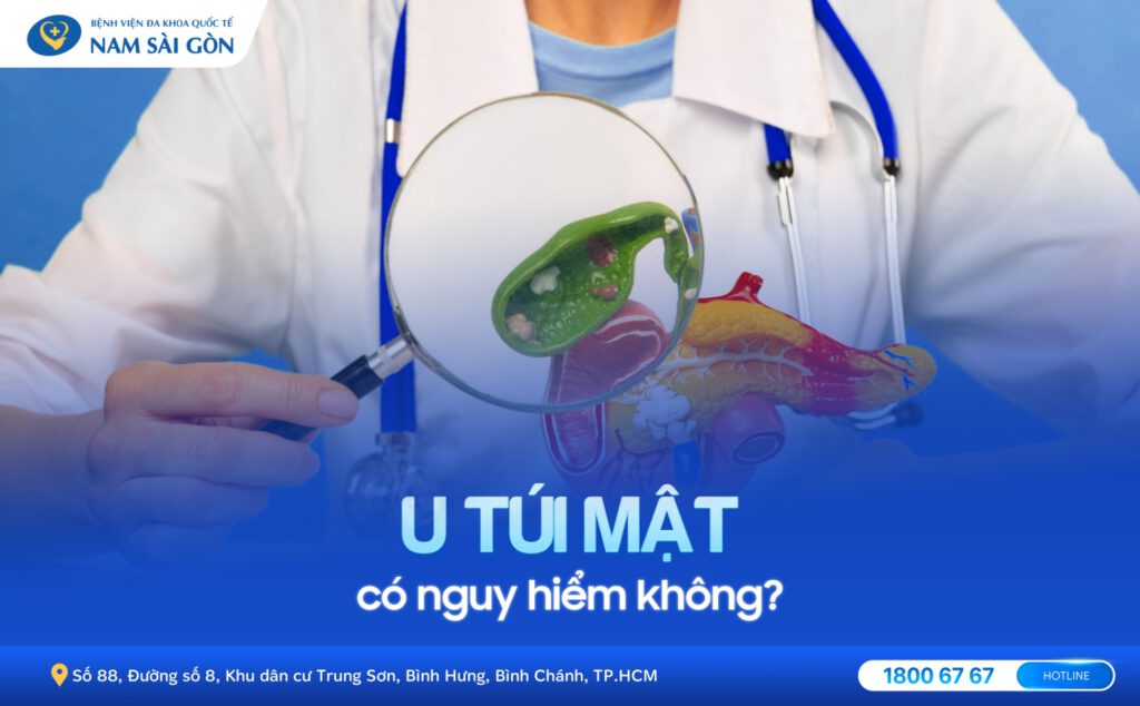 u túi mật