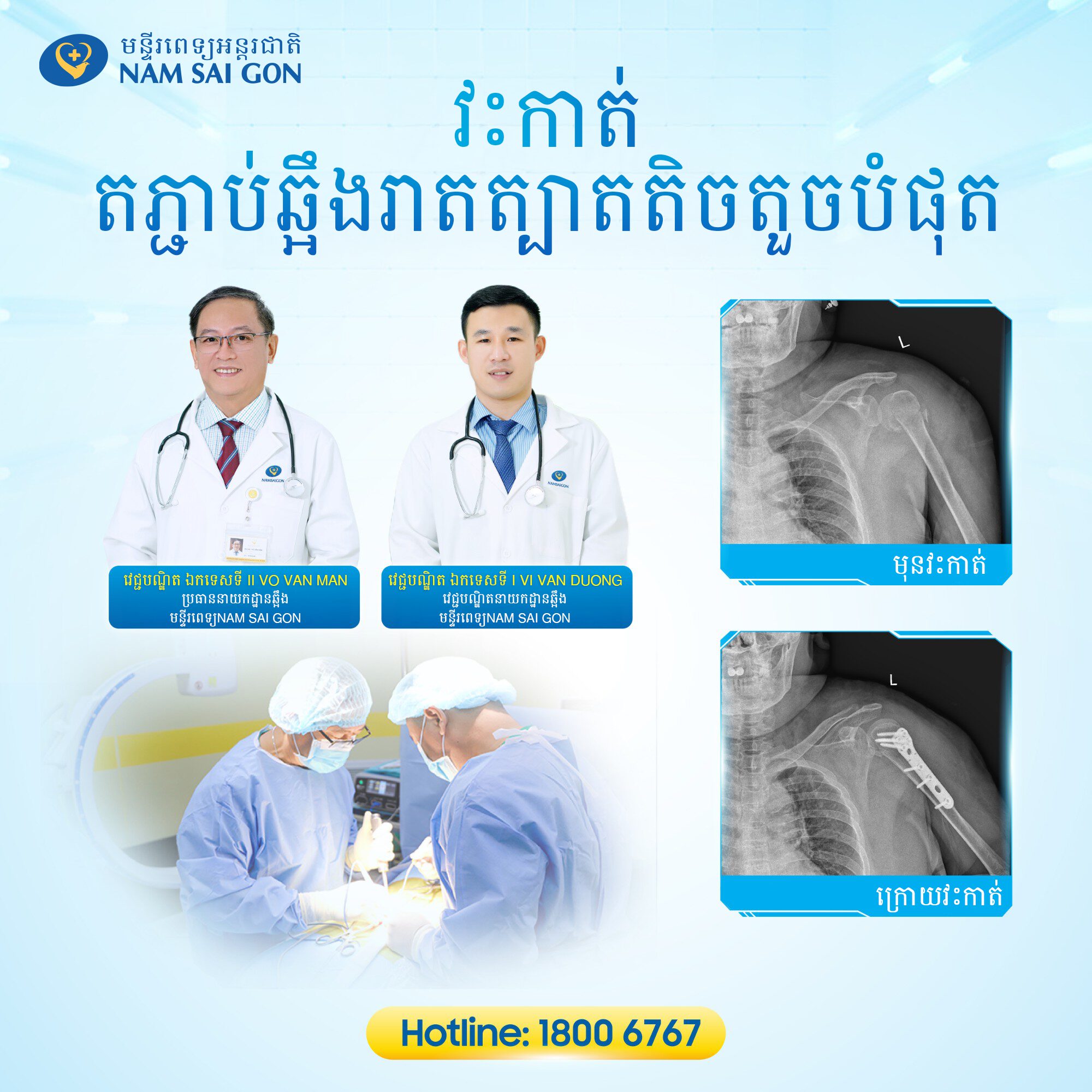 កម្មវិធីនៃការវះកាត់ឆ្អឹងដែលរាតត្បាតតិចតួចក្នុងការព្យាបាលការបាក់បែកឆ្អឹងកនឹងដៃ