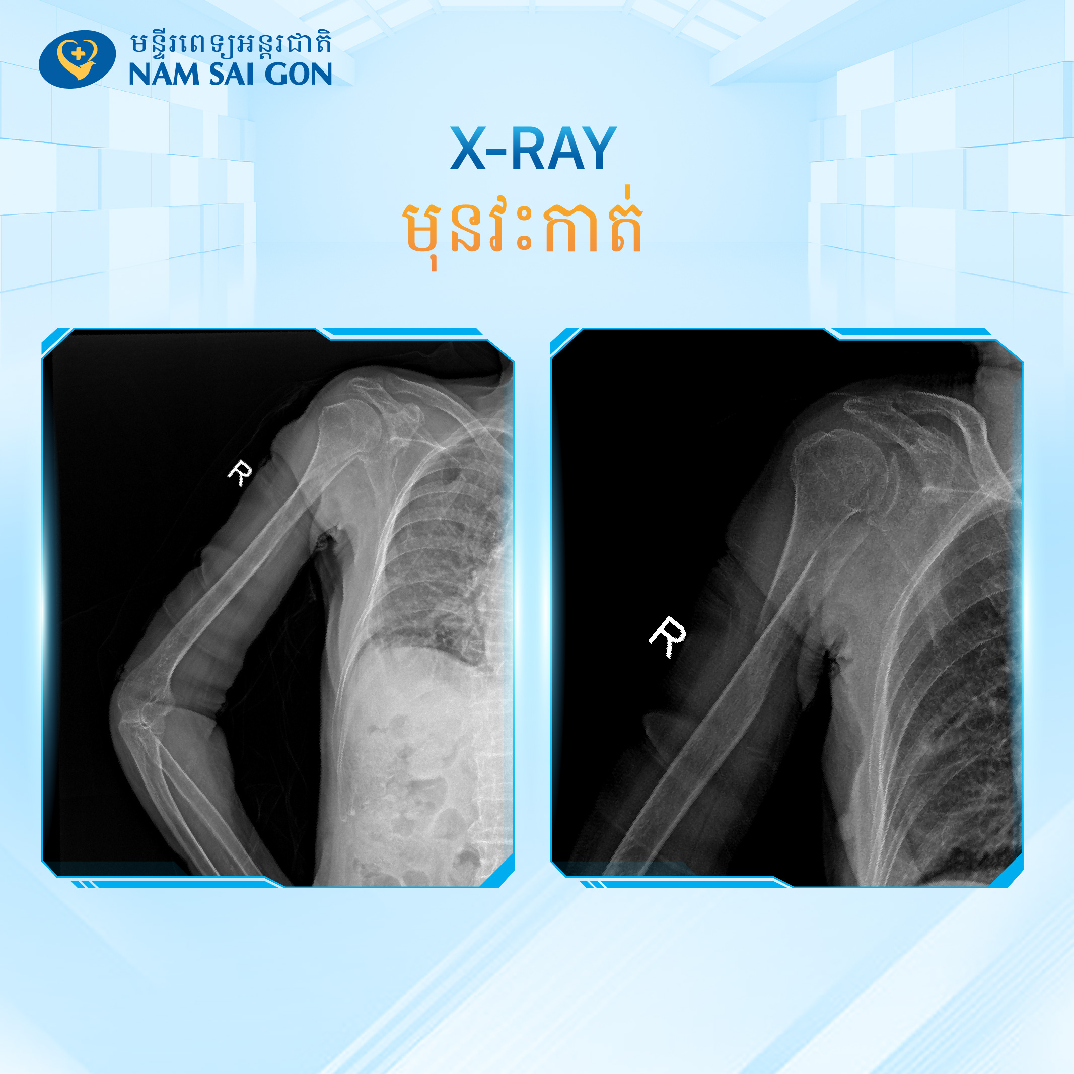 Bai 14 khmer Banner 1 1