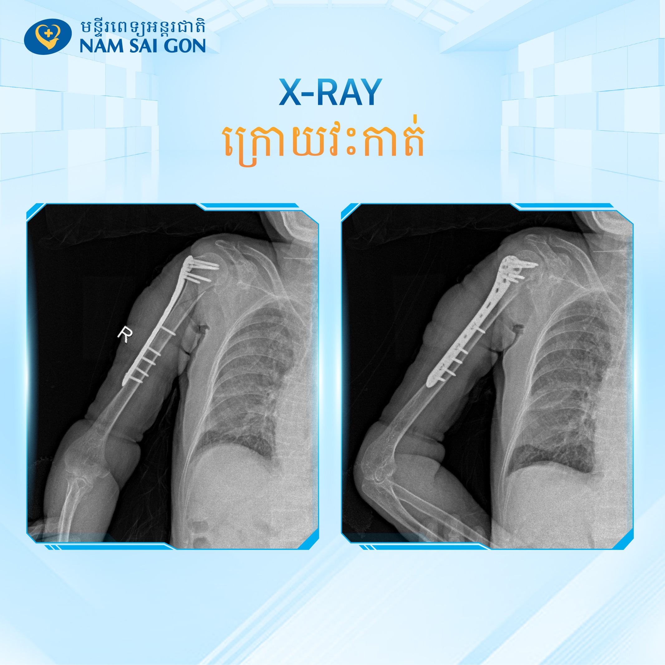 Bai 14 khmer Banner 1 copy 2