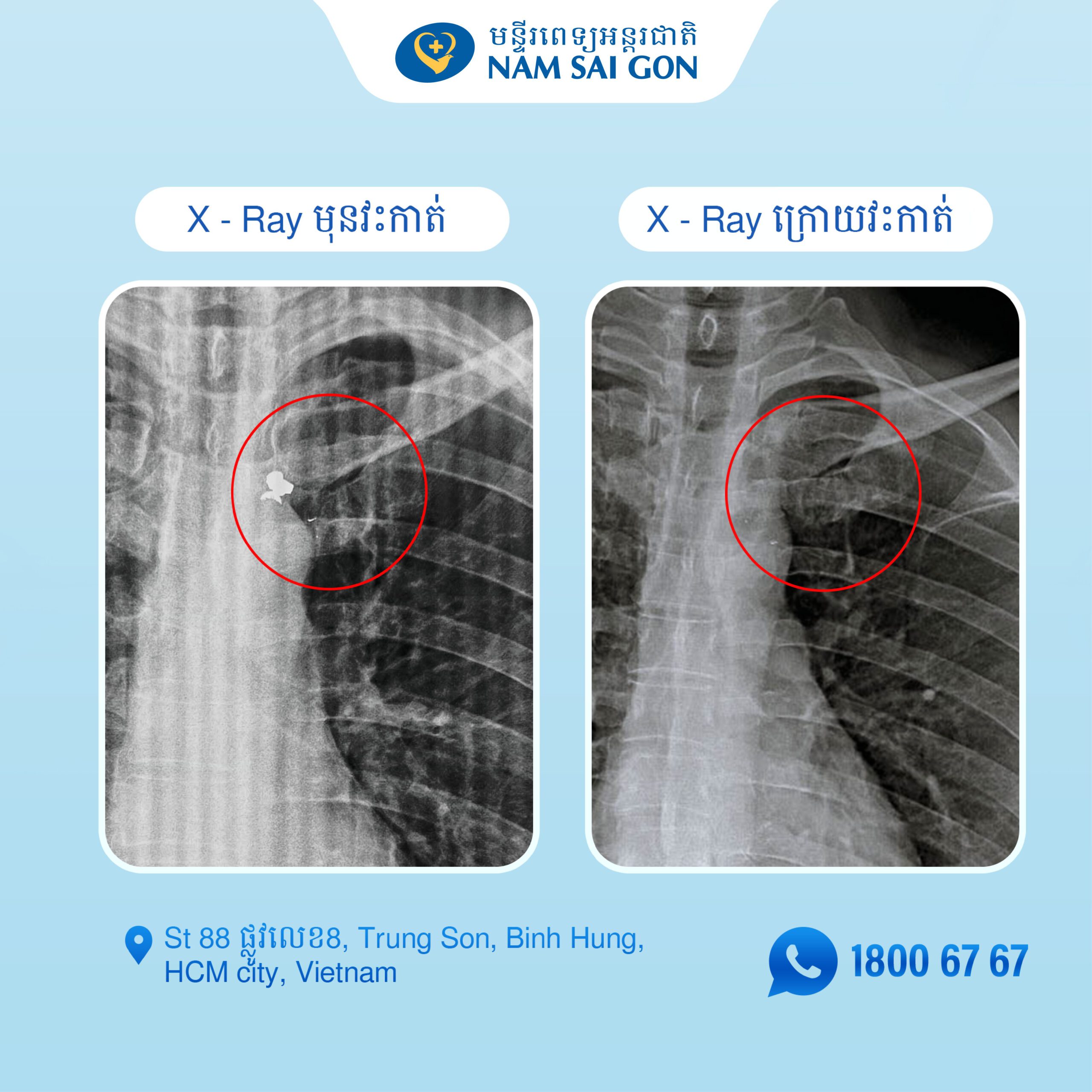 BAI 13 KHMER Banner 1