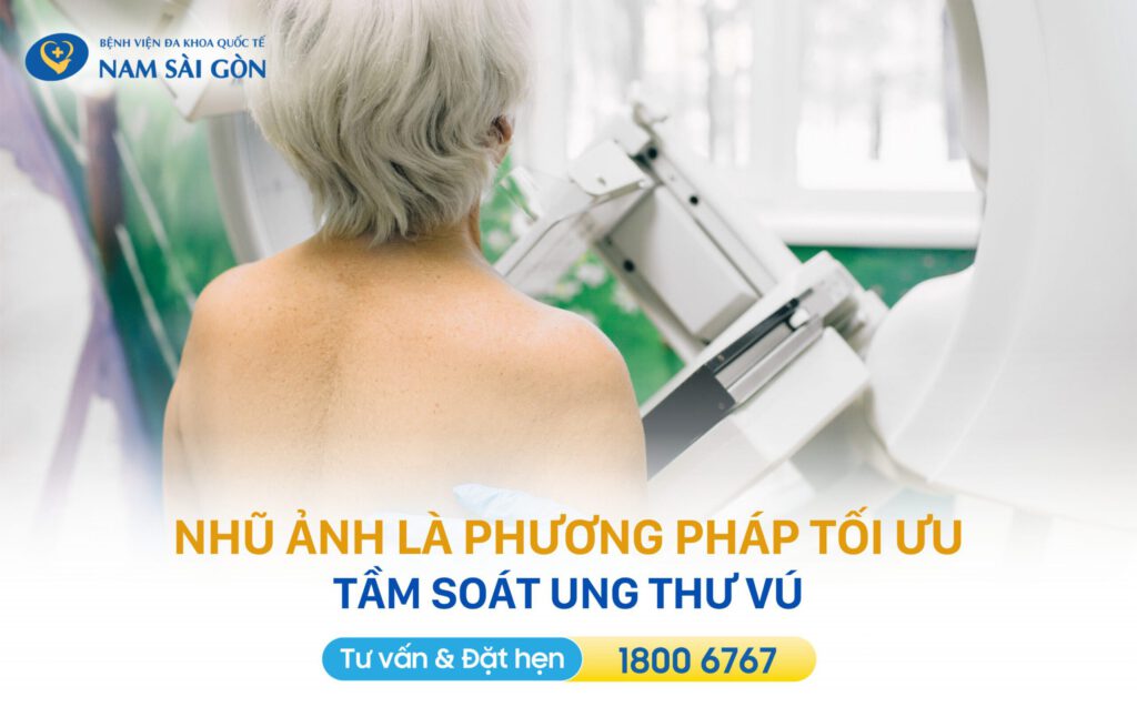 nhũ ảnh phương pháp tối ưu tầm soát ung thư vú