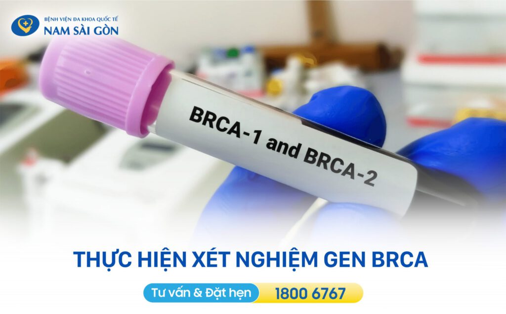 khám ung thư vú xét nghiệm gen giúp tầm soát ung thư vú