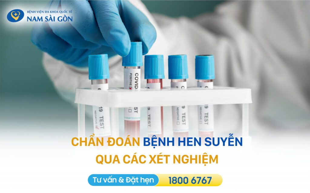 hen suyễn là bệnh gì Chẩn đoán hen suyễn như thế nào