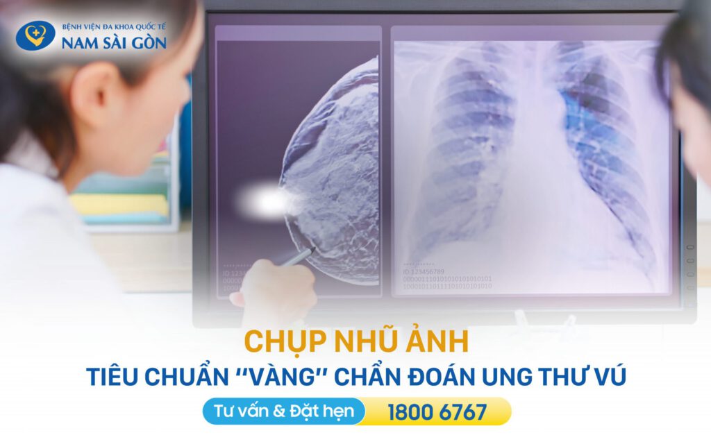 nhũ ảnh tầm soát hiệu quả ung thư vú