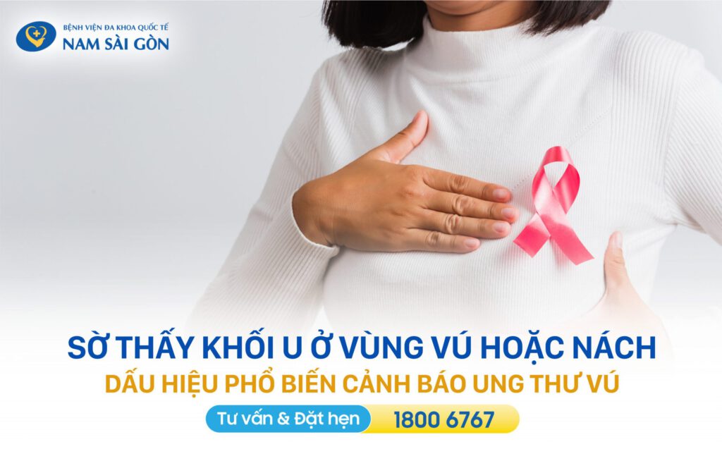 sờ thấy khối u có thể dấu hiệu ung thư vú