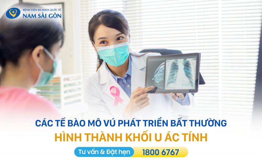 ung thư vú là tình trạng các mô vú phát triển bất thường hình thành khối u ác tính