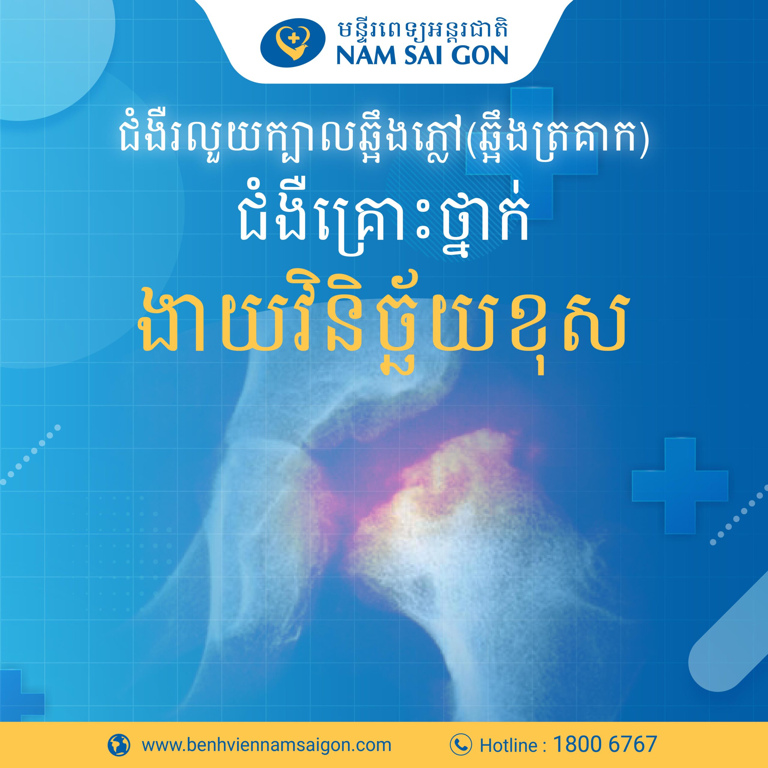 រលួយក្បាលឆ្អឹងភ្លៅ(ឆ្អឹងក្បាលត្រគាក)  – ជំងឺគ្រោះថ្នាក់ងាយរោគវិនិច្ឆ័យខុស
