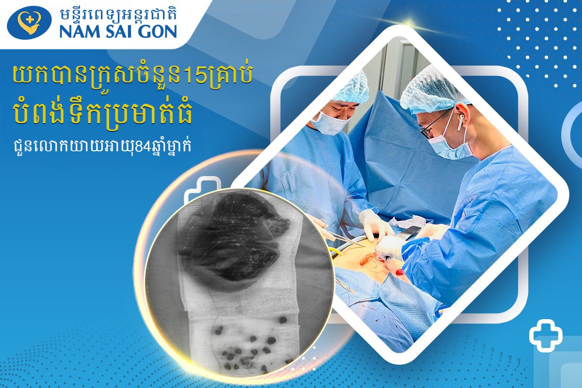 យកក្រួសចំនួន15គ្រាប់ចេញពីថង់ប្រមាត់ជួនលោកយាយអាយុ84ឆ្នាំម្នាក់