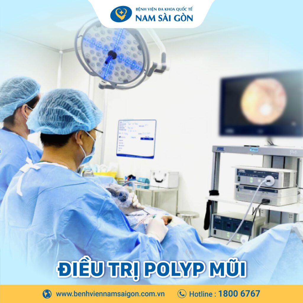 Điều trị polyp mũi 