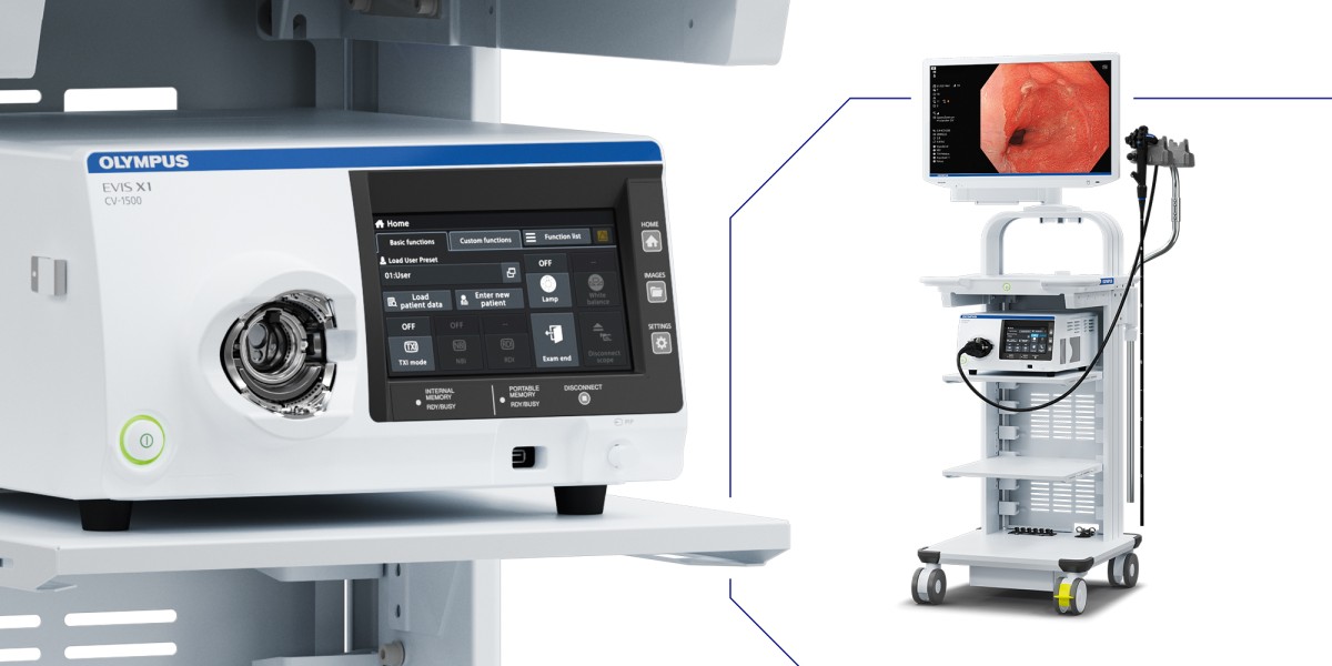 Hệ thống nội soi Olympus EVIS X1 CV1500 – Giải pháp vàng trong tầm soát tiêu hóa