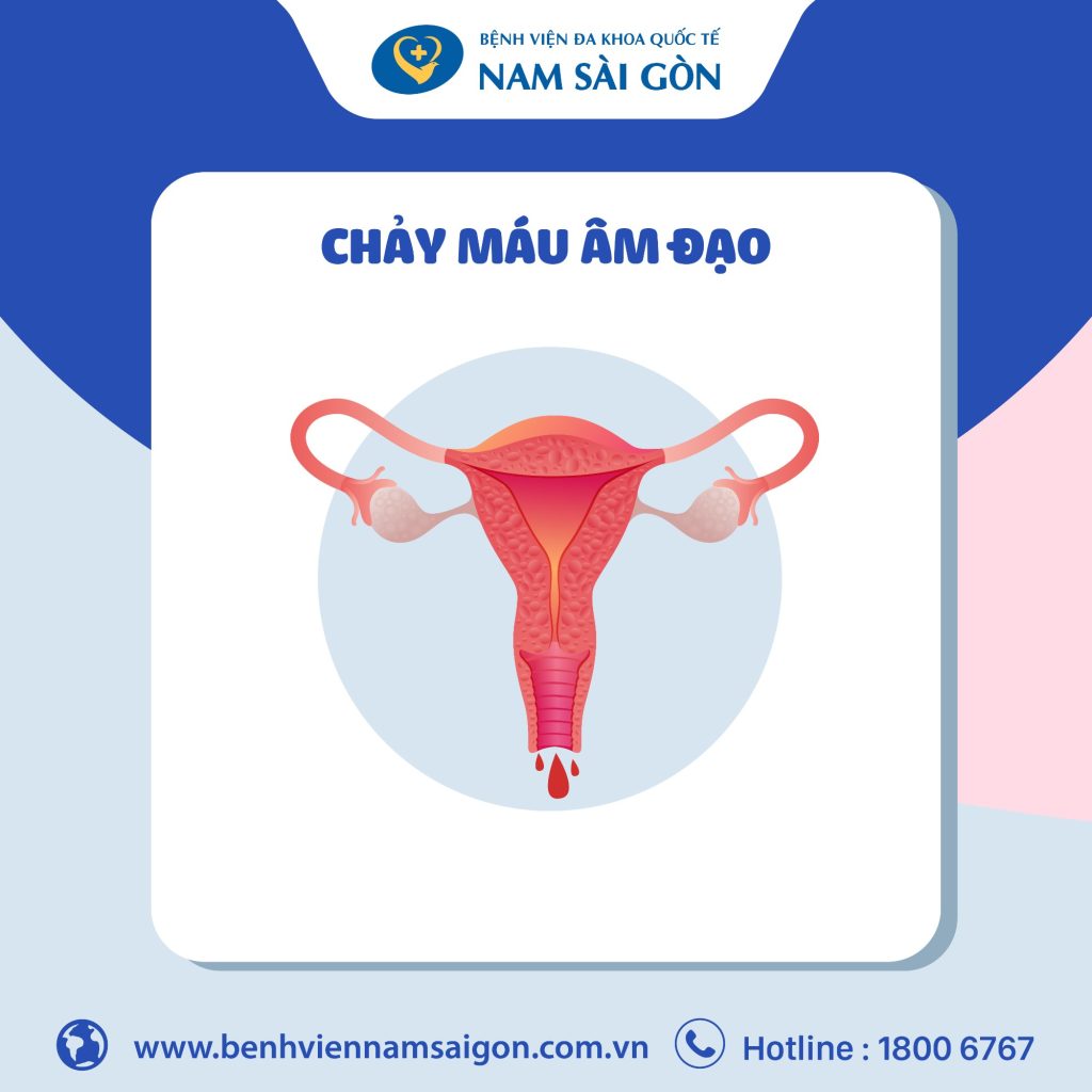 Chảy Máu Âm Đạo